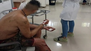 Fue a una supuesta cita y le terminaron golpeando y robando - Noticias Paraguay