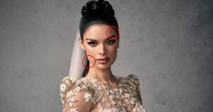 La Nación / ¿Nadia Ferreira con retoques estéticos para su boda?