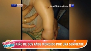 Niño de dos años sufre mordedura de serpiente en San Pedro