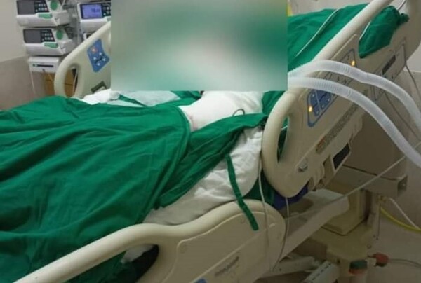 Fallece joven que sufrió graves quemaduras en el cuerpo | 1000 Noticias