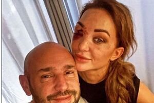 Miss Bélgica sobrevivió a terrible accidente de tránsito