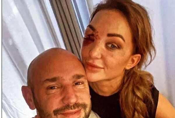Miss Bélgica sobrevivió a terrible accidente de tránsito