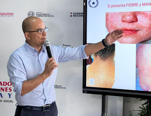 Alerta epidemiológica por sarampión: instan a padres a vacunar a sus hijos - trece