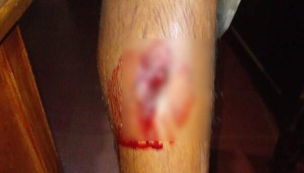 ¡Chan! Pilló que era cornudo y encima terminó baleado