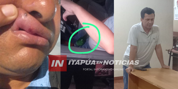 POLICÍA HABRÍA ATROPELLADO UNA BARRERA DE CONTROL Y GOLPEADO A UN AGENTE DE TRÁNSITO - Itapúa Noticias