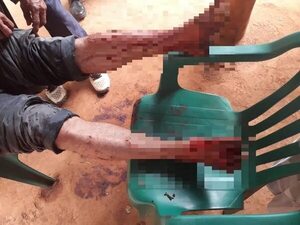 Caazapá: amenazó a una mujer con un machete, recibió balines de plomo y resultó detenido - Policiales - ABC Color