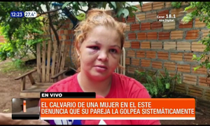 El calvario de una mujer | Telefuturo