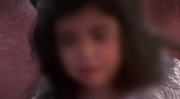 Caso único en el mundo: Niña de 7 años es diagnosticada con cáncer de mama