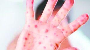 Salud puede recurrir a la Defensoría contra los papás antivacunas