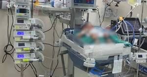 La Nación / Chikungunya: Salud reporta 51 niños menores de un año internados en UTI