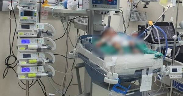 La Nación / Chikungunya: Salud reporta 51 niños menores de un año internados en UTI