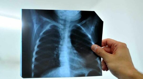 Detienen a radiólogo por abusar de un niño en Hospital de CDE: “No dejó entrar al padre”