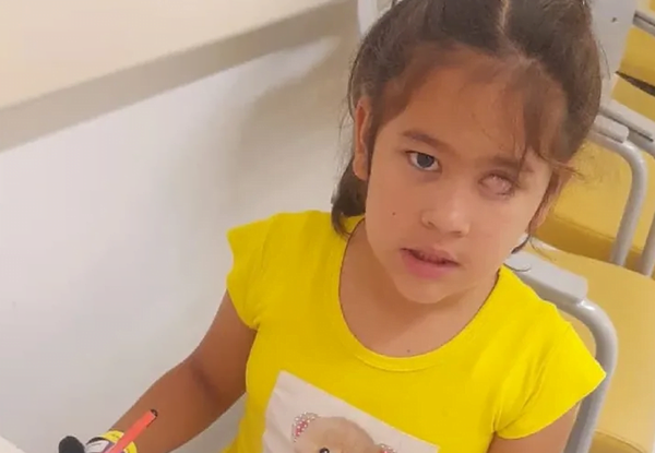 Thaís podría perder su único ojito si no consigue fondos para su tratamiento - Noticiero Paraguay