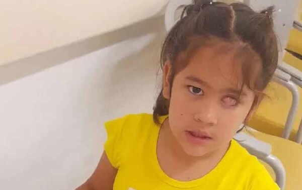 Thaís podría perder su único ojito si no consigue fondos para su tratamiento – Prensa 5