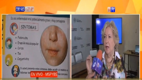Advierten que el sarampión puede dejar secuelas a largo plazo - Noticias Paraguay