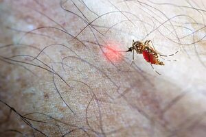 AUDIO: Chikunguña: “Gracias a la fisioterapia, se puede paliar muchos síntomas que quedan en forma persistente”, dice fisioterapeuta - Contacto Ciudadano - ABC Color