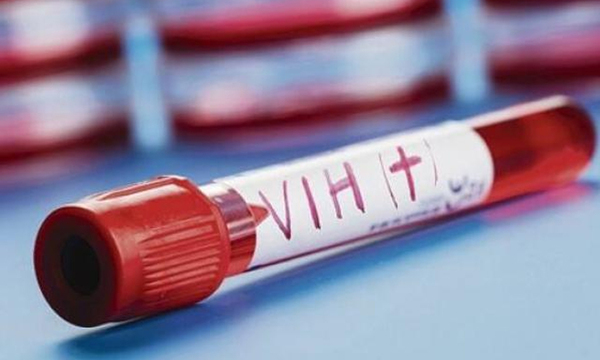 Un paciente alemán, el tercero del mundo que se cura del VIH - OviedoPress