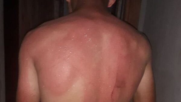 Brasileño cintareó brutalmente a adolescente porque se negó a seguir trabajando