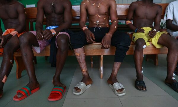 (VIDEO) Al menos 19 heridos por explosión en evento deportivo en Camerún