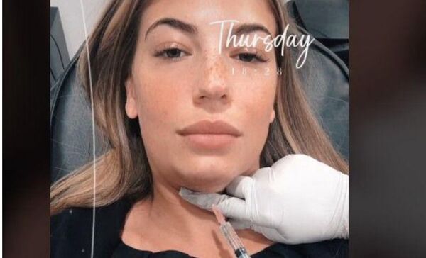 Quiso quitarse la papada y luego parecía “una rana”