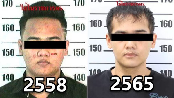Diario HOY | Narcotraficante buscado en Tailandia recurrió a la cirugía plástica para evitar ser arrestado