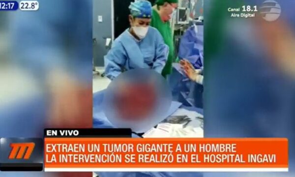 Extraen tumor gigante a un hombre en IPS Ingavi | Telefuturo