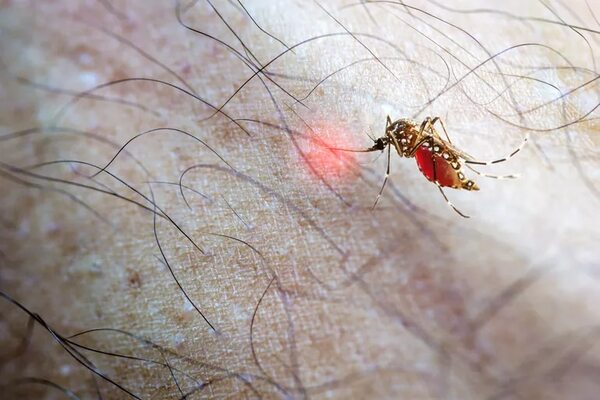 AUDIO: Chikunguña: “En ningún lugar se describe así la gravedad que está teniendo en Paraguay” - Ancho Perfil - ABC Color