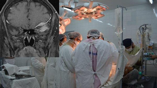 Médicos de IPS extraen un tumor de más de diez kilos