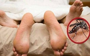 Chikunguña y su incidencia en la actividad sexual – Prensa 5