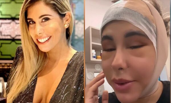 (Video) ¡Maga Caballero quedó con el rostro desfigurado!