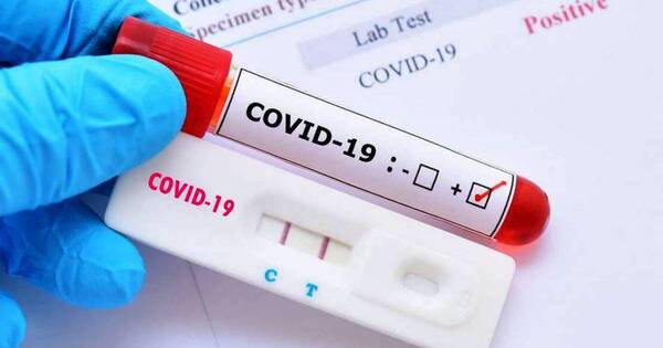 La Nación / COVID-19 muestra un descenso en la cantidad de casos