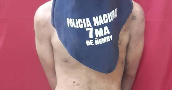 La Nación / Un hombre recibió dos disparos en Ñemby y quedó en estado delicado