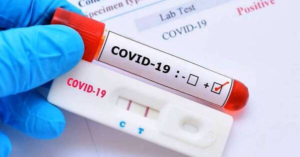 La Nación / Covid-19 muestra descenso de casos