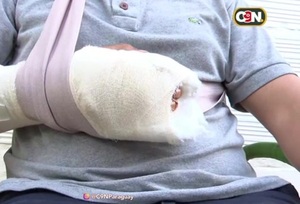 Itá: Macheteado por su padrastro - C9N