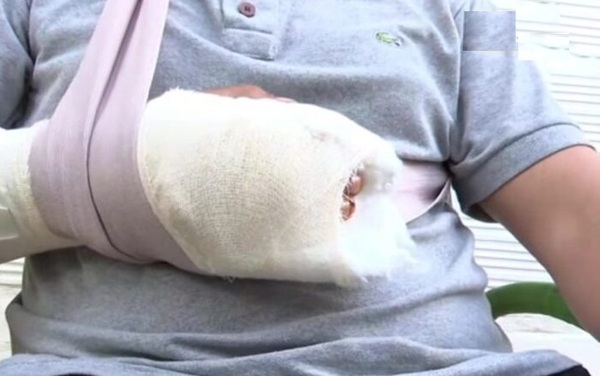 Diario HOY | Macheteó a su hijastro por "despertarlo" accidentalmente: “Me vino para matar”