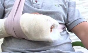 Macheteó a su hijastro por “despertarlo” accidentalmente - Noticiero Paraguay
