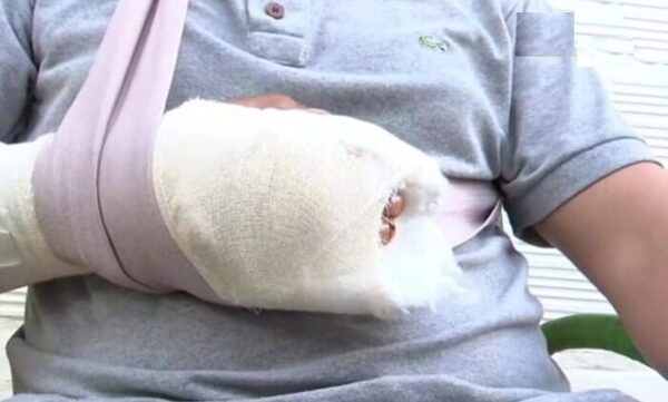 Macheteó a su hijastro por “despertarlo” accidentalmente - Noticiero Paraguay
