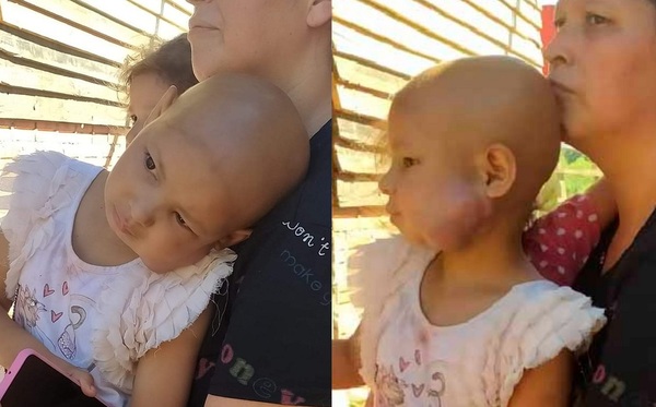 Madre de niña con tumor apela a la solidaridad ovetense para costear medicamentos - Noticiero Paraguay