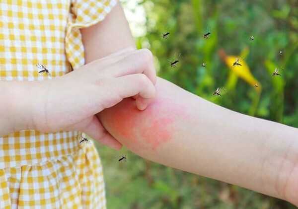 Virus de chikungunya en niños pequeños: ¿qué debe llamar la atención? | Lambaré Informativo