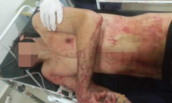 Hieren a un hombre en Remansito