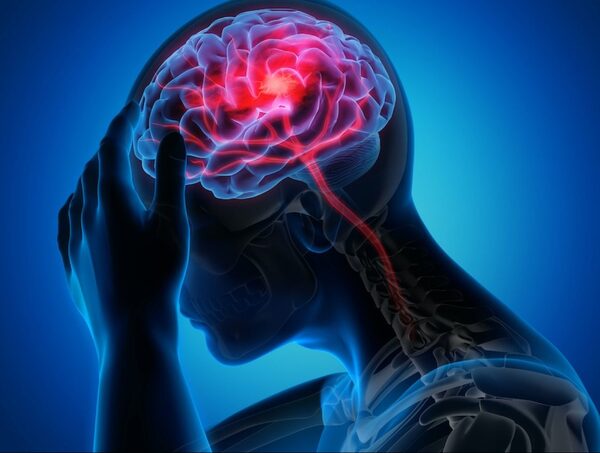 Clínicas: Observan más afecciones neurológicas en pacientes internados por chikunguña · Radio Monumental 1080 AM