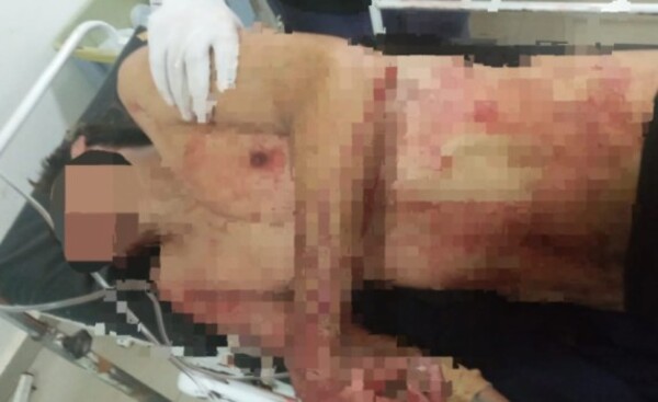 Joven fue apuñalado en el cuello, anoche