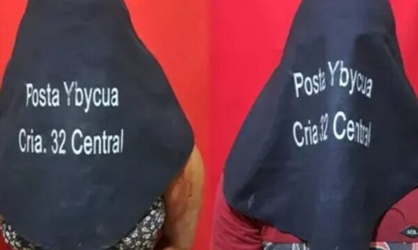Rompió la nariz de su novio por no darle su lelu