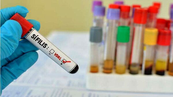 Salud registra alta tendencia de sífilis y sífilis congénita en el país