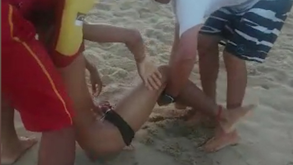 Diario HOY | Adolescentes atacados y mutilados por tiburones en playa de Brasil