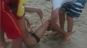 Adolescentes fueron mutilados por tiburones en playa de Brasil - Radio Imperio