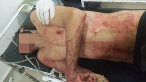 Joven casi es degollado durante pelea en Ciudad del Este