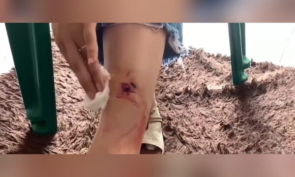 Mujeres fueron atacadas y mordidas por un perro
