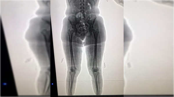 ¡Quelle folie! Quisieron ir a Francia con kilos de merca pegados al cuerpo