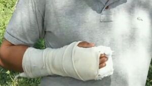 Un joven fue macheteado supuestamente por su padrastro en Itá